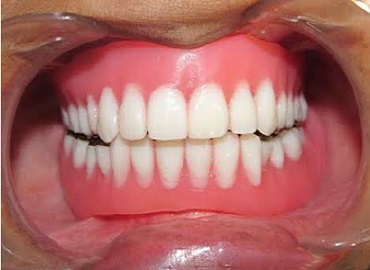 Dental Clinic in Gomti Nagar,Dental Clinic in vibhuti khand,Dental clinic in vishesh khand,dental clinic near shaheed path,Dentist in Gomti Nagar,Dentist in vibhuti khand,Dentist in vishesh khand,Dentist near shaheed path,Dental clinic in lucknow,dentist in lucknow,top dental clinic in gomti nagar,top dental clinic in vibhuti khand,top dental clinic in vishesh khand,top dental clinic  near shaheed path,top dentist in gomti nagar,top dentist in vibhuti khand,top dentist in vishesh khand