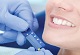 Shivam Dental Clinic & Implant Center
