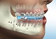 Shivam Dental Clinic & Implant Center