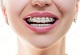 Shivam Dental Clinic & Implant Center